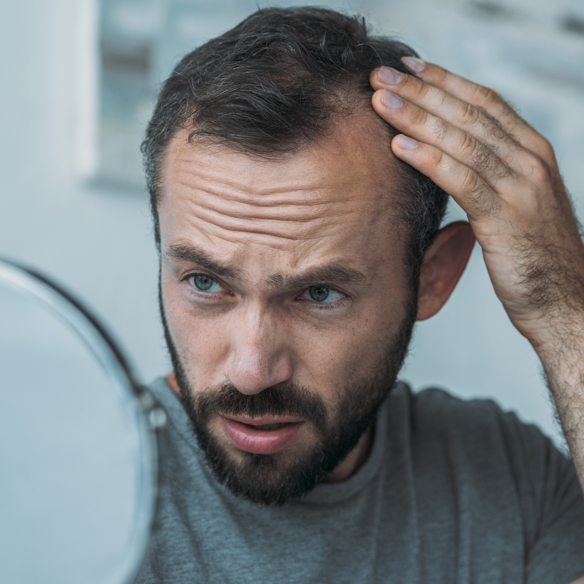 Perte de cheveux : comprendre, prévenir et trouver la solution adaptée