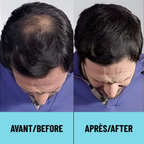 CAPii - Hair Concealing Cream