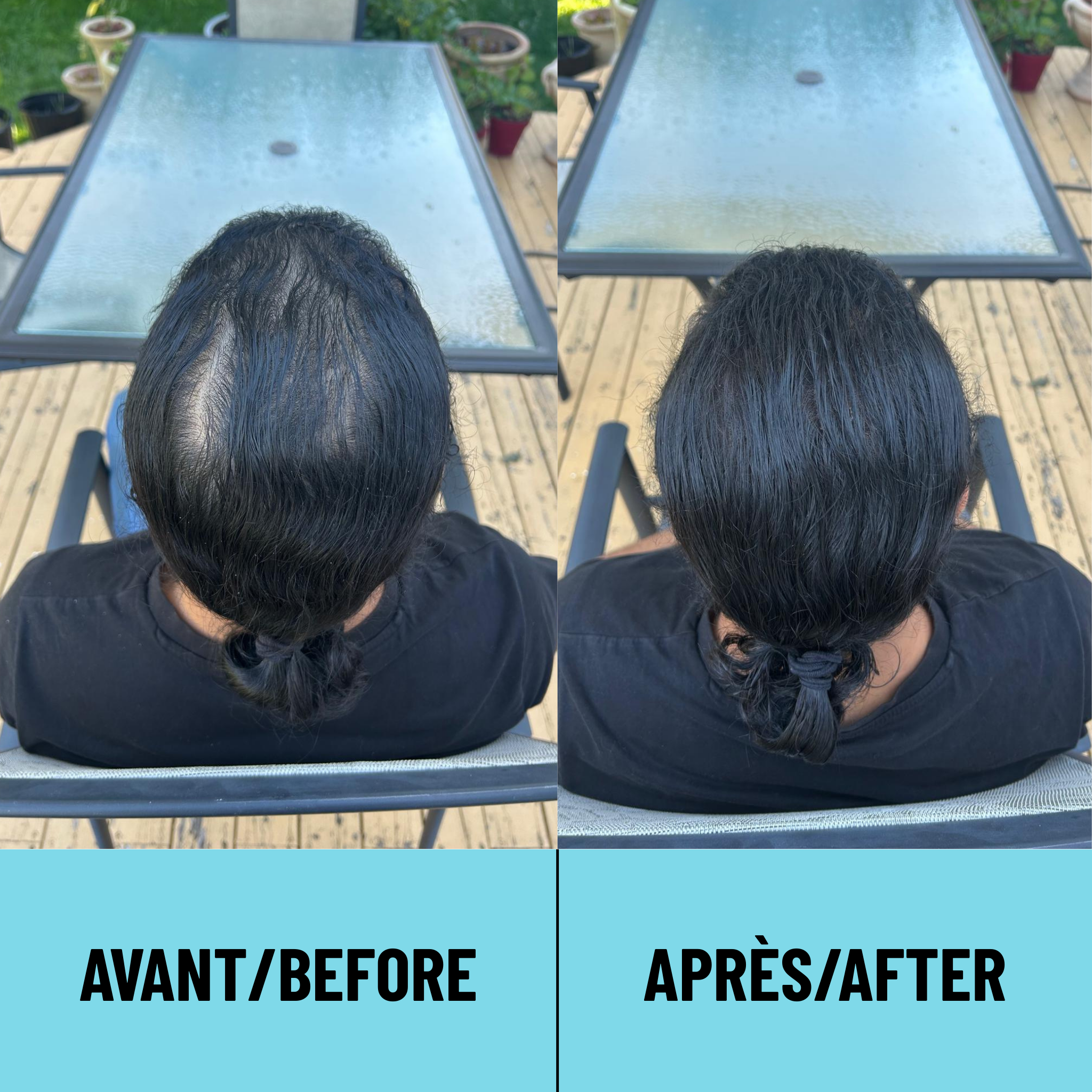 CAPii - Hair Concealing Cream