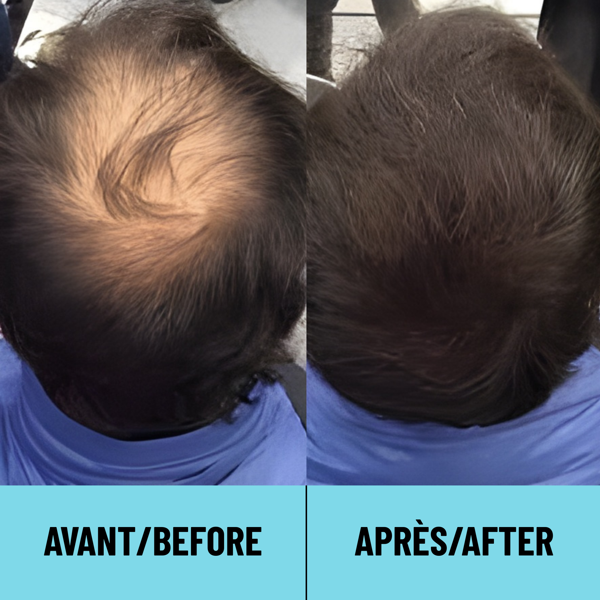 CAPii - Hair Concealing Cream