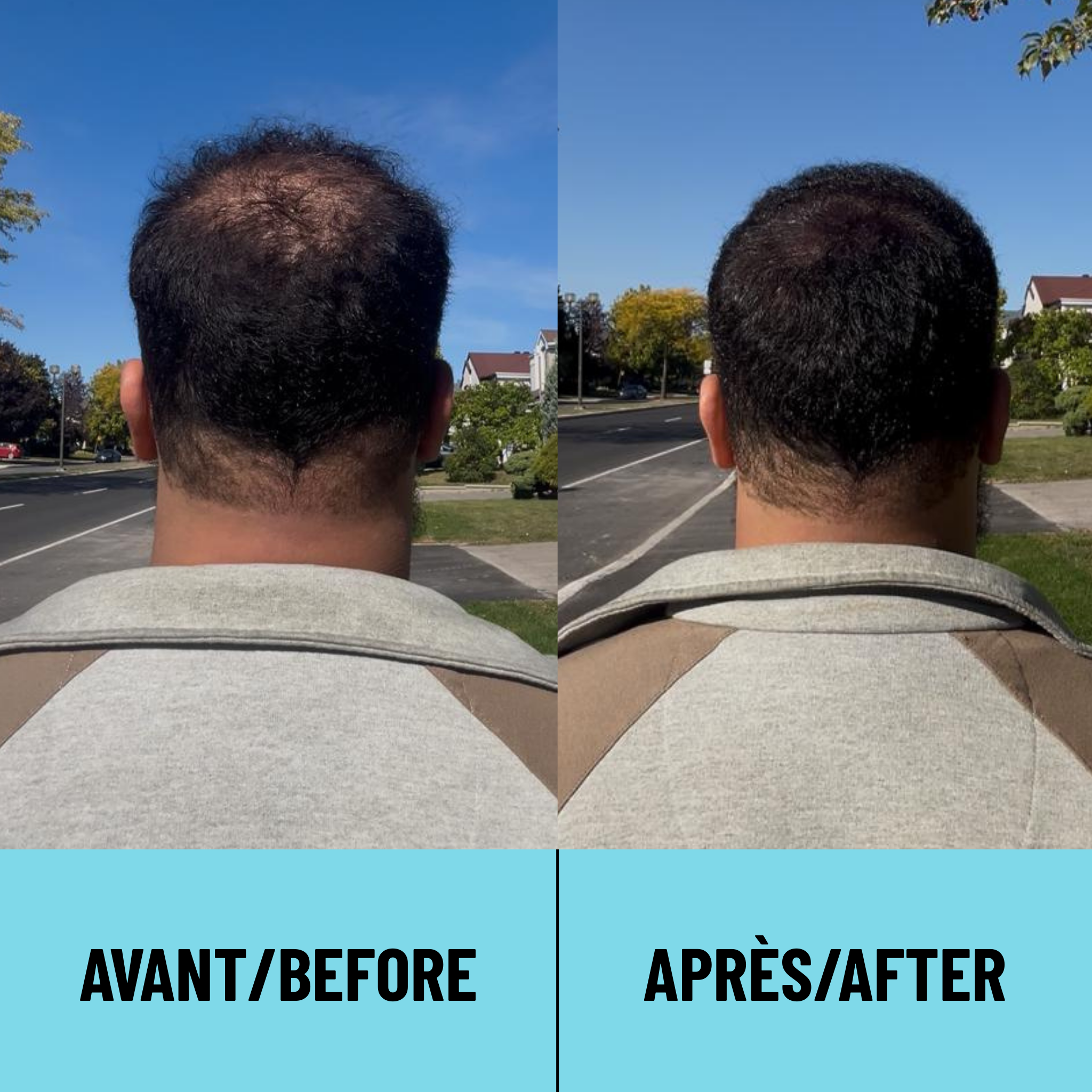 CAPii - Hair Concealing Cream