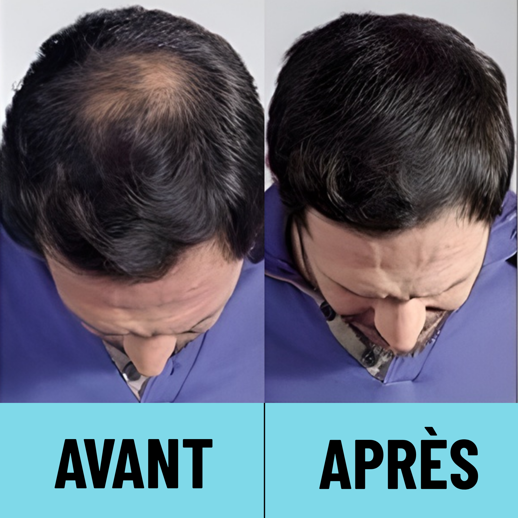 CAPii - Crème Correctrice Capillaire