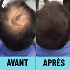 CAPii - Crème Correctrice Capillaire