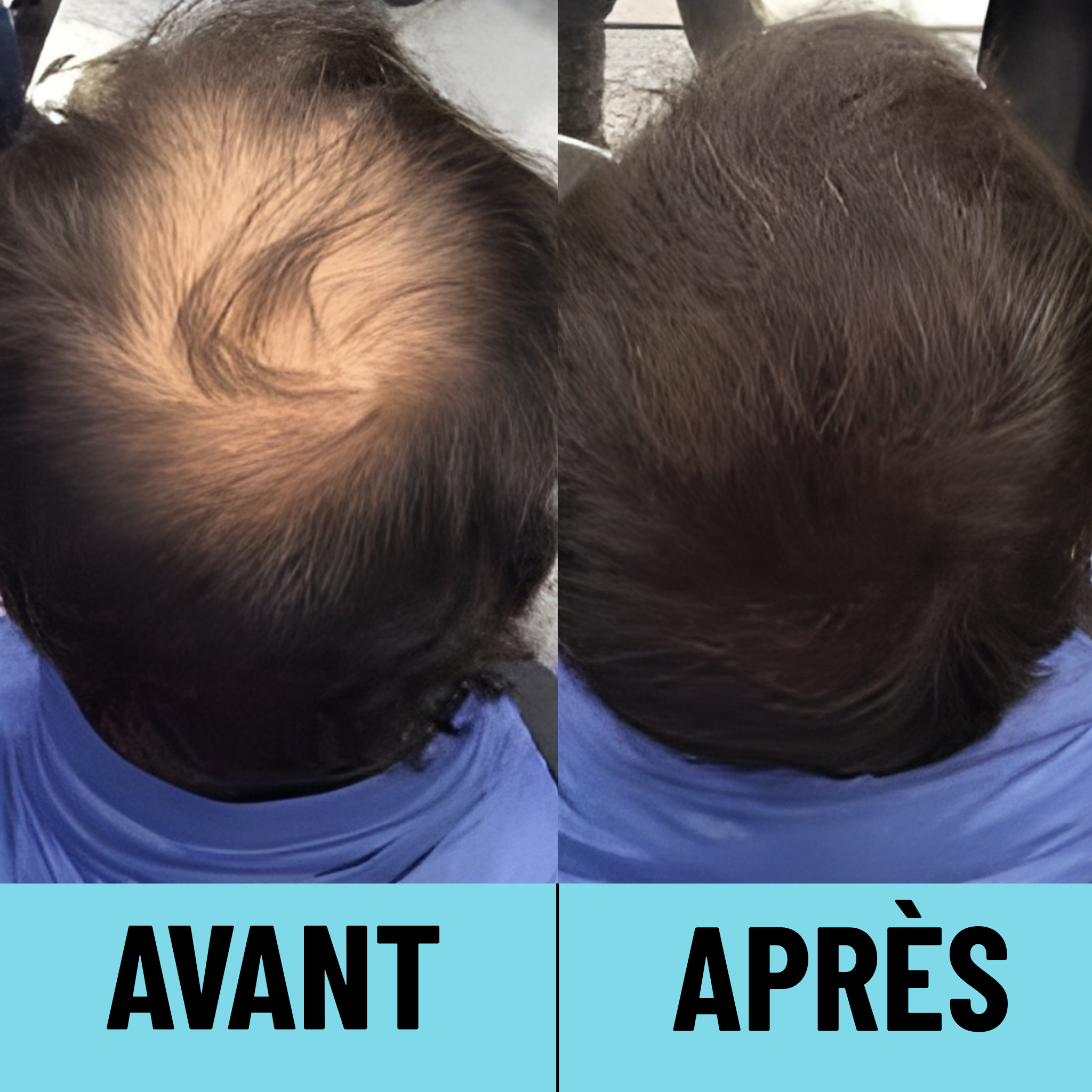 CAPii - Crème Correctrice Capillaire