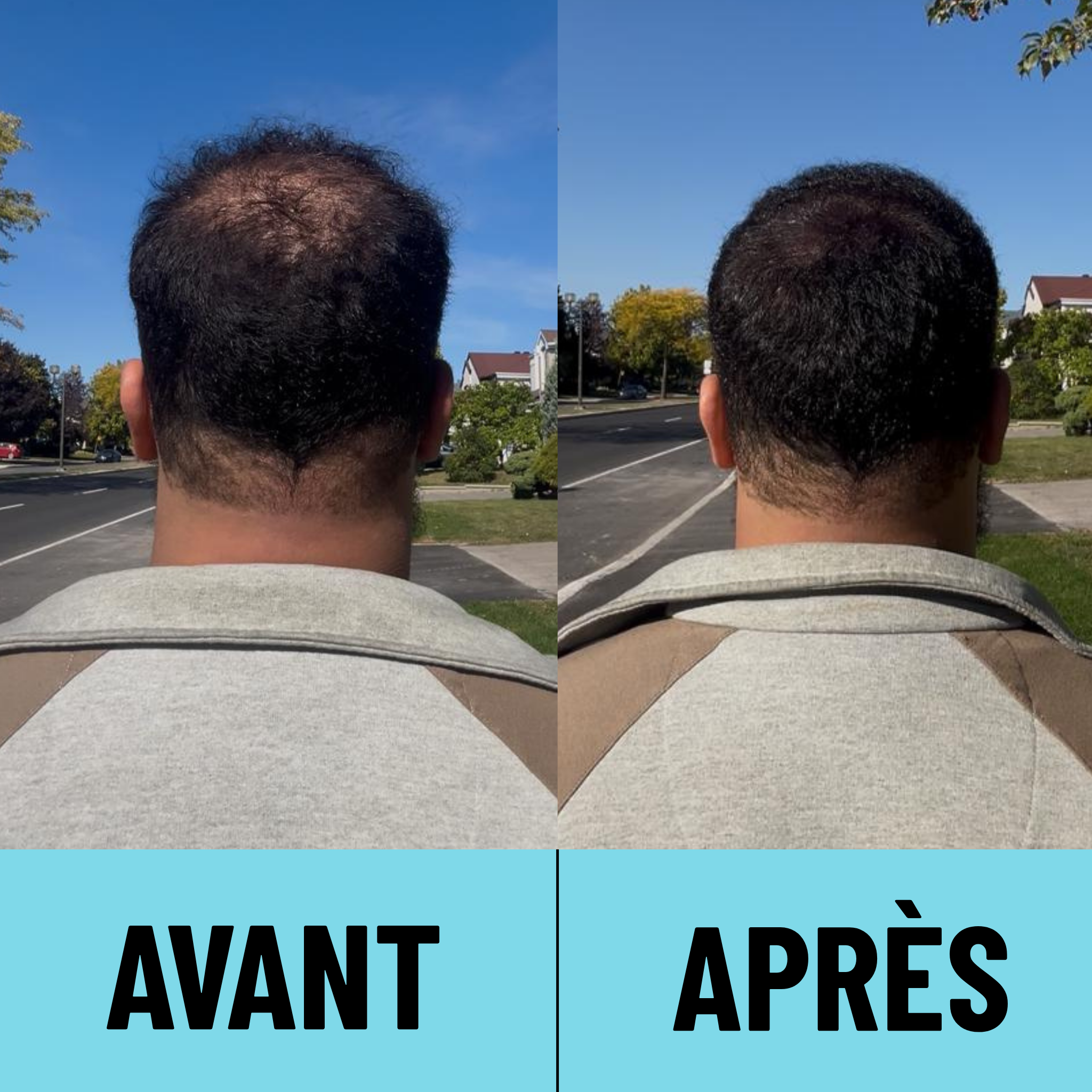 CAPii - Crème Correctrice Capillaire